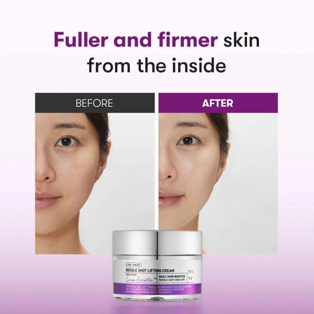 VT Cosmetics Reedle Shot Lifting Cream kasutamise tulemus – naha tihedus ja elastsus paranevad.